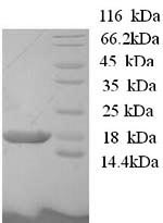 (Tris-Glycine gel) Discontinuous SDS-PAGE (reduced) with 5% enrichment gel and 15% separation gel. (Tris-Glycine gel) Discontinuous SDS-PAGE (reduced) with 5% enrichment gel and 15% separation gel.