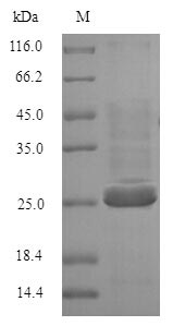 (Tris-Glycine gel) Discontinuous SDS-PAGE (reduced) with 5% enrichment gel and 15% separation gel. (Tris-Glycine gel) Discontinuous SDS-PAGE (reduced) with 5% enrichment gel and 15% separation gel.
