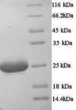 SDS-PAGE- Recombinant protein Mouse C1qa