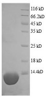 (Tris-Glycine gel) Discontinuous SDS-PAGE (reduced) with 5% enrichment gel and 15% separation gel. (Tris-Glycine gel) Discontinuous SDS-PAGE (reduced) with 5% enrichment gel and 15% separation gel.