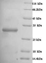 SDS-PAGE- Recombinant protein Human CA1