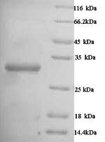 (Tris-Glycine gel) Discontinuous SDS-PAGE (reduced) with 5% enrichment gel and 15% separation gel. (Tris-Glycine gel) Discontinuous SDS-PAGE (reduced) with 5% enrichment gel and 15% separation gel.