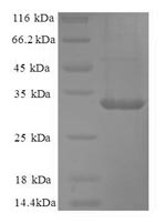 (Tris-Glycine gel) Discontinuous SDS-PAGE (reduced) with 5% enrichment gel and 15% separation gel. (Tris-Glycine gel) Discontinuous SDS-PAGE (reduced) with 5% enrichment gel and 15% separation gel.
