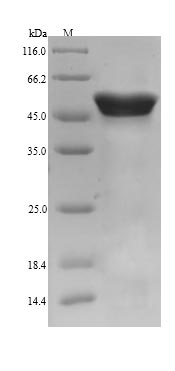 (Tris-Glycine gel) Discontinuous SDS-PAGE (reduced) with 5% enrichment gel and 15% separation gel.