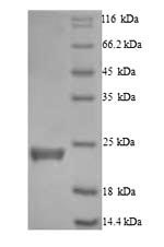 (Tris-Glycine gel) Discontinuous SDS-PAGE (reduced) with 5% enrichment gel and 15% separation gel. (Tris-Glycine gel) Discontinuous SDS-PAGE (reduced) with 5% enrichment gel and 15% separation gel.