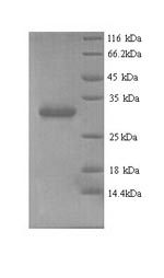 (Tris-Glycine gel) Discontinuous SDS-PAGE (reduced) with 5% enrichment gel and 15% separation gel. (Tris-Glycine gel) Discontinuous SDS-PAGE (reduced) with 5% enrichment gel and 15% separation gel.