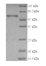 (Tris-Glycine gel) Discontinuous SDS-PAGE (reduced) with 5% enrichment gel and 15% separation gel. (Tris-Glycine gel) Discontinuous SDS-PAGE (reduced) with 5% enrichment gel and 15% separation gel.