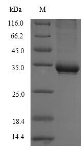 (Tris-Glycine gel) Discontinuous SDS-PAGE (reduced) with 5% enrichment gel and 15% separation gel. (Tris-Glycine gel) Discontinuous SDS-PAGE (reduced) with 5% enrichment gel and 15% separation gel.