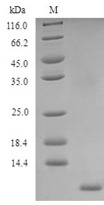 (Tris-Glycine gel) Discontinuous SDS-PAGE (reduced) with 5% enrichment gel and 15% separation gel. (Tris-Glycine gel) Discontinuous SDS-PAGE (reduced) with 5% enrichment gel and 15% separation gel.