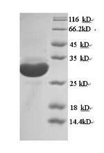 (Tris-Glycine gel) Discontinuous SDS-PAGE (reduced) with 5% enrichment gel and 15% separation gel. (Tris-Glycine gel) Discontinuous SDS-PAGE (reduced) with 5% enrichment gel and 15% separation gel.