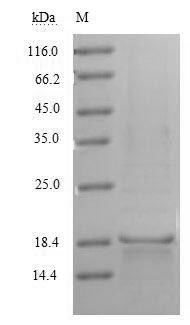 (Tris-Glycine gel) Discontinuous SDS-PAGE (reduced) with 5% enrichment gel and 15% separation gel. (Tris-Glycine gel) Discontinuous SDS-PAGE (reduced) with 5% enrichment gel and 15% separation gel.