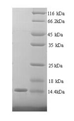 (Tris-Glycine gel) Discontinuous SDS-PAGE (reduced) with 5% enrichment gel and 15% separation gel. (Tris-Glycine gel) Discontinuous SDS-PAGE (reduced) with 5% enrichment gel and 15% separation gel.