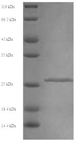 (Tris-Glycine gel) Discontinuous SDS-PAGE (reduced) with 5% enrichment gel and 15% separation gel. (Tris-Glycine gel) Discontinuous SDS-PAGE (reduced) with 5% enrichment gel and 15% separation gel.