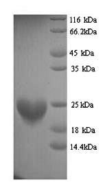 (Tris-Glycine gel) Discontinuous SDS-PAGE (reduced) with 5% enrichment gel and 15% separation gel. (Tris-Glycine gel) Discontinuous SDS-PAGE (reduced) with 5% enrichment gel and 15% separation gel.