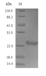 (Tris-Glycine gel) Discontinuous SDS-PAGE (reduced) with 5% enrichment gel and 15% separation gel. (Tris-Glycine gel) Discontinuous SDS-PAGE (reduced) with 5% enrichment gel and 15% separation gel.