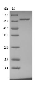 (Tris-Glycine gel) Discontinuous SDS-PAGE (reduced) with 5% enrichment gel and 15% separation gel. (Tris-Glycine gel) Discontinuous SDS-PAGE (reduced) with 5% enrichment gel and 15% separation gel.