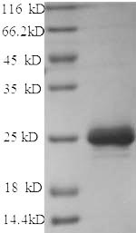 (Tris-Glycine gel) Discontinuous SDS-PAGE (reduced) with 5% enrichment gel and 15% separation gel. (Tris-Glycine gel) Discontinuous SDS-PAGE (reduced) with 5% enrichment gel and 15% separation gel.