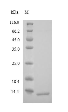 (Tris-Glycine gel) Discontinuous SDS-PAGE (reduced) with 5% enrichment gel and 15% separation gel. (Tris-Glycine gel) Discontinuous SDS-PAGE (reduced) with 5% enrichment gel and 15% separation gel.
