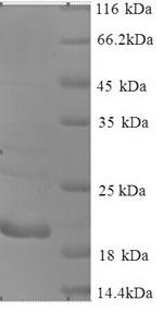 SDS-PAGE- Recombinant protein Human CTAG1A