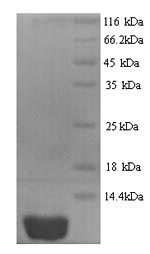 (Tris-Glycine gel) Discontinuous SDS-PAGE (reduced) with 5% enrichment gel and 15% separation gel. (Tris-Glycine gel) Discontinuous SDS-PAGE (reduced) with 5% enrichment gel and 15% separation gel.