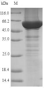 (Tris-Glycine gel) Discontinuous SDS-PAGE (reduced) with 5% enrichment gel and 15% separation gel. (Tris-Glycine gel) Discontinuous SDS-PAGE (reduced) with 5% enrichment gel and 15% separation gel.