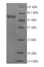 SDS-PAGE- Recombinant protein Mouse Cyp2e1