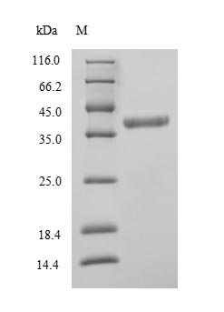 (Tris-Glycine gel) Discontinuous SDS-PAGE (reduced) with 5% enrichment gel and 15% separation gel. (Tris-Glycine gel) Discontinuous SDS-PAGE (reduced) with 5% enrichment gel and 15% separation gel.
