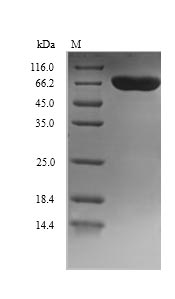 (Tris-Glycine gel) Discontinuous SDS-PAGE (reduced) with 5% enrichment gel and 15% separation gel. (Tris-Glycine gel) Discontinuous SDS-PAGE (reduced) with 5% enrichment gel and 15% separation gel.