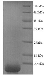 (Tris-Glycine gel) Discontinuous SDS-PAGE (reduced) with 5% enrichment gel and 15% separation gel. (Tris-Glycine gel) Discontinuous SDS-PAGE (reduced) with 5% enrichment gel and 15% separation gel.