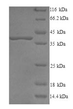 (Tris-Glycine gel) Discontinuous SDS-PAGE (reduced) with 5% enrichment gel and 15% separation gel. (Tris-Glycine gel) Discontinuous SDS-PAGE (reduced) with 5% enrichment gel and 15% separation gel.
