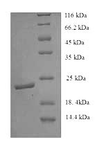 (Tris-Glycine gel) Discontinuous SDS-PAGE (reduced) with 5% enrichment gel and 15% separation gel. (Tris-Glycine gel) Discontinuous SDS-PAGE (reduced) with 5% enrichment gel and 15% separation gel.