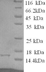 (Tris-Glycine gel) Discontinuous SDS-PAGE (reduced) with 5% enrichment gel and 15% separation gel. (Tris-Glycine gel) Discontinuous SDS-PAGE (reduced) with 5% enrichment gel and 15% separation gel.