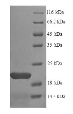 (Tris-Glycine gel) Discontinuous SDS-PAGE (reduced) with 5% enrichment gel and 15% separation gel. (Tris-Glycine gel) Discontinuous SDS-PAGE (reduced) with 5% enrichment gel and 15% separation gel.