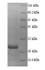 (Tris-Glycine gel) Discontinuous SDS-PAGE (reduced) with 5% enrichment gel and 15% separation gel. (Tris-Glycine gel) Discontinuous SDS-PAGE (reduced) with 5% enrichment gel and 15% separation gel.