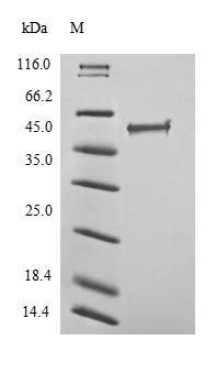 (Tris-Glycine gel) Discontinuous SDS-PAGE (reduced) with 5% enrichment gel and 15% separation gel. (Tris-Glycine gel) Discontinuous SDS-PAGE (reduced) with 5% enrichment gel and 15% separation gel.
