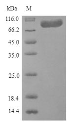 (Tris-Glycine gel) Discontinuous SDS-PAGE (reduced) with 5% enrichment gel and 15% separation gel. (Tris-Glycine gel) Discontinuous SDS-PAGE (reduced) with 5% enrichment gel and 15% separation gel.