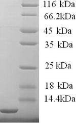 SDS-PAGE- Recombinant protein Human FCER1G