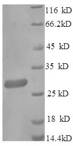 (Tris-Glycine gel) Discontinuous SDS-PAGE (reduced) with 5% enrichment gel and 15% separation gel. (Tris-Glycine gel) Discontinuous SDS-PAGE (reduced) with 5% enrichment gel and 15% separation gel.