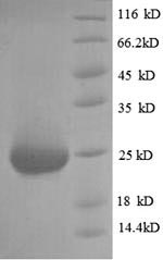 (Tris-Glycine gel) Discontinuous SDS-PAGE (reduced) with 5% enrichment gel and 15% separation gel. (Tris-Glycine gel) Discontinuous SDS-PAGE (reduced) with 5% enrichment gel and 15% separation gel.