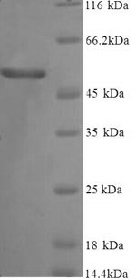 (Tris-Glycine gel) Discontinuous SDS-PAGE (reduced) with 5% enrichment gel and 15% separation gel. (Tris-Glycine gel) Discontinuous SDS-PAGE (reduced) with 5% enrichment gel and 15% separation gel.