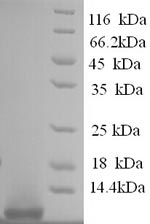 (Tris-Glycine gel) Discontinuous SDS-PAGE (reduced) with 5% enrichment gel and 15% separation gel. (Tris-Glycine gel) Discontinuous SDS-PAGE (reduced) with 5% enrichment gel and 15% separation gel.