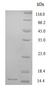 (Tris-Glycine gel) Discontinuous SDS-PAGE (reduced) with 5% enrichment gel and 15% separation gel. (Tris-Glycine gel) Discontinuous SDS-PAGE (reduced) with 5% enrichment gel and 15% separation gel.