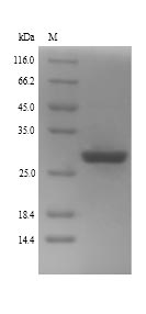 (Tris-Glycine gel) Discontinuous SDS-PAGE (reduced) with 5% enrichment gel and 15% separation gel. (Tris-Glycine gel) Discontinuous SDS-PAGE (reduced) with 5% enrichment gel and 15% separation gel.