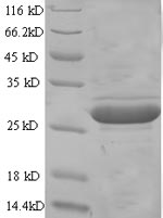 (Tris-Glycine gel) Discontinuous SDS-PAGE (reduced) with 5% enrichment gel and 15% separation gel. (Tris-Glycine gel) Discontinuous SDS-PAGE (reduced) with 5% enrichment gel and 15% separation gel.