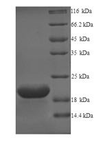 (Tris-Glycine gel) Discontinuous SDS-PAGE (reduced) with 5% enrichment gel and 15% separation gel. (Tris-Glycine gel) Discontinuous SDS-PAGE (reduced) with 5% enrichment gel and 15% separation gel.
