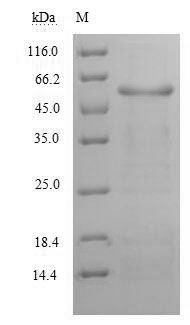 SDS-PAGE- Recombinant protein Human GPT