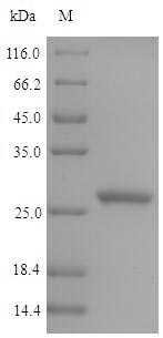 (Tris-Glycine gel) Discontinuous SDS-PAGE (reduced) with 5% enrichment gel and 15% separation gel. (Tris-Glycine gel) Discontinuous SDS-PAGE (reduced) with 5% enrichment gel and 15% separation gel.