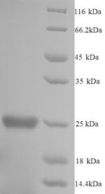 (Tris-Glycine gel) Discontinuous SDS-PAGE (reduced) with 5% enrichment gel and 15% separation gel. (Tris-Glycine gel) Discontinuous SDS-PAGE (reduced) with 5% enrichment gel and 15% separation gel.