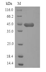 (Tris-Glycine gel) Discontinuous SDS-PAGE (reduced) with 5% enrichment gel and 15% separation gel. (Tris-Glycine gel) Discontinuous SDS-PAGE (reduced) with 5% enrichment gel and 15% separation gel.
