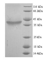 (Tris-Glycine gel) Discontinuous SDS-PAGE (reduced) with 5% enrichment gel and 15% separation gel. (Tris-Glycine gel) Discontinuous SDS-PAGE (reduced) with 5% enrichment gel and 15% separation gel.